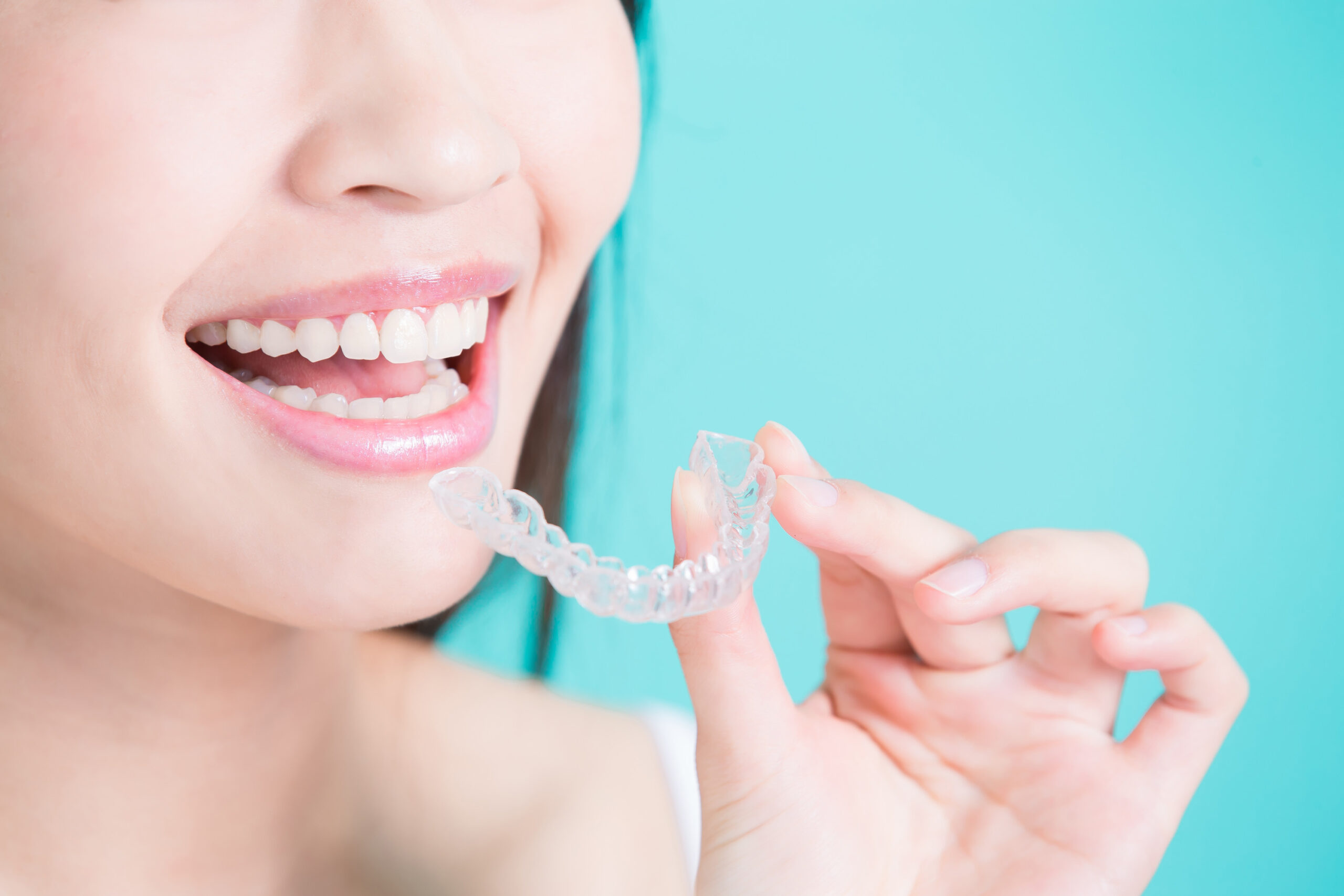 Invisalign vs Braces: Which one is better for you? - Brite Orthodontics